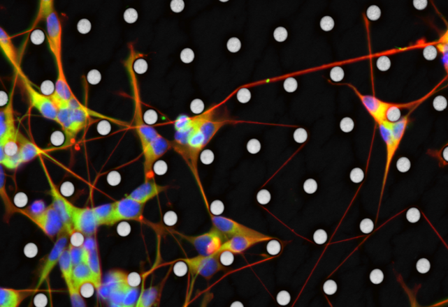 Organic Bioelectronics